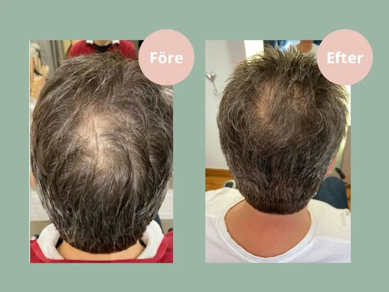 Mot håravfall  Hjärtligt Hair Growth Schampo
